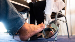 Diabetic Foot Issues To Know And Simple Ways To Prevent Them